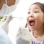 5歳の子どもの歯の状態は？ 気をつけることは？