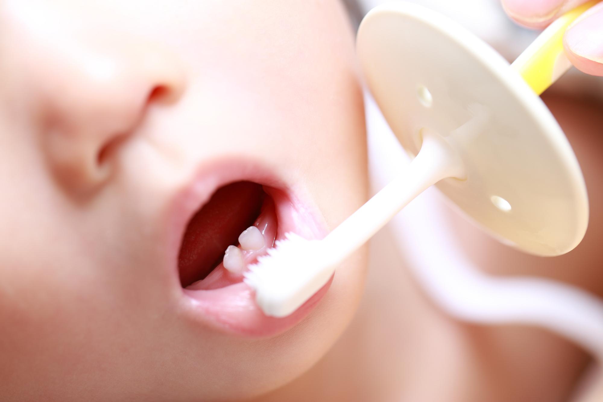赤ちゃんの歯みがきはガーゼ 歯ブラシ 成長に合わせたケア
