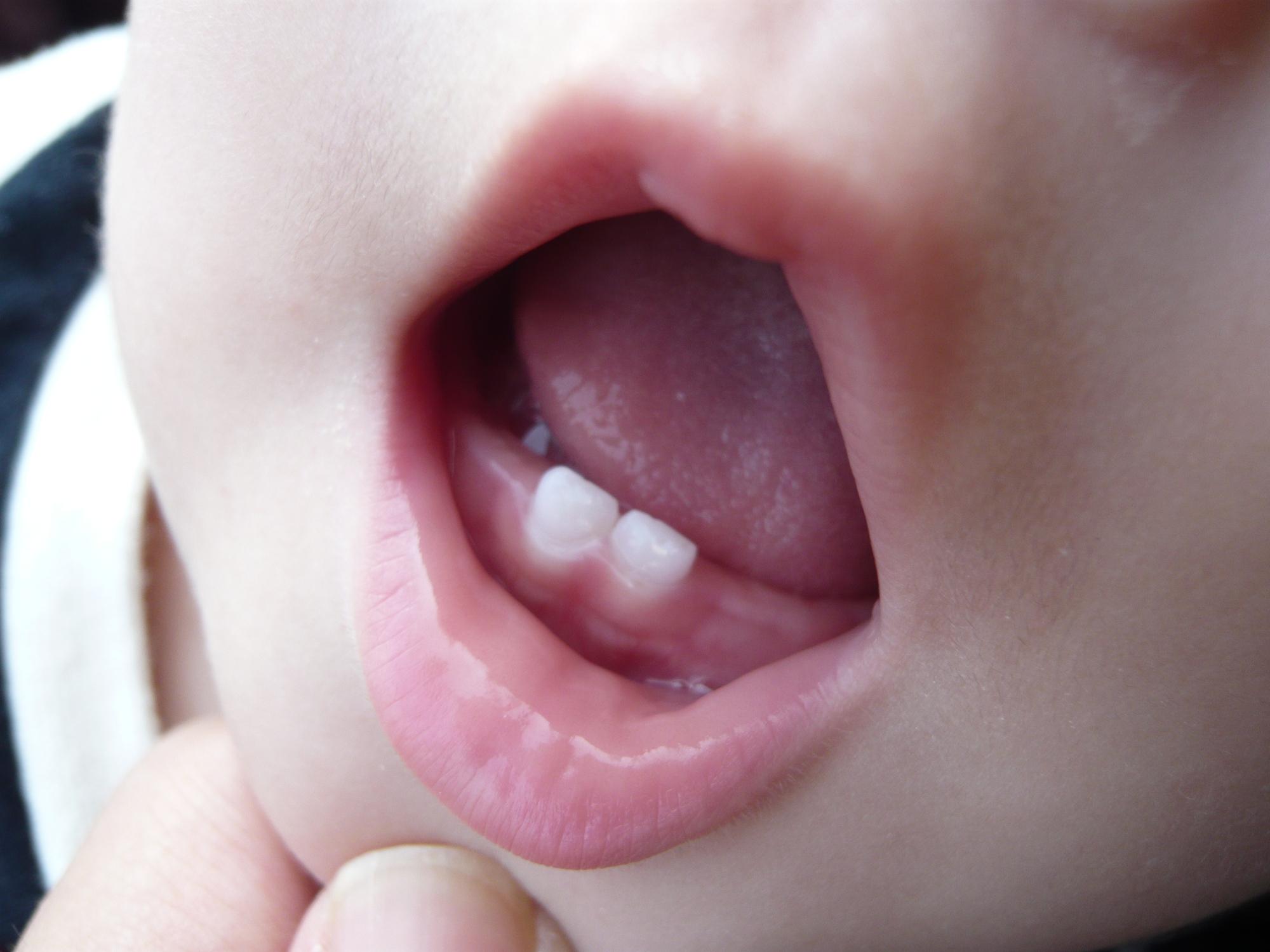 赤ちゃんの歯みがき粉はいつからok 選び方の6つのポイント