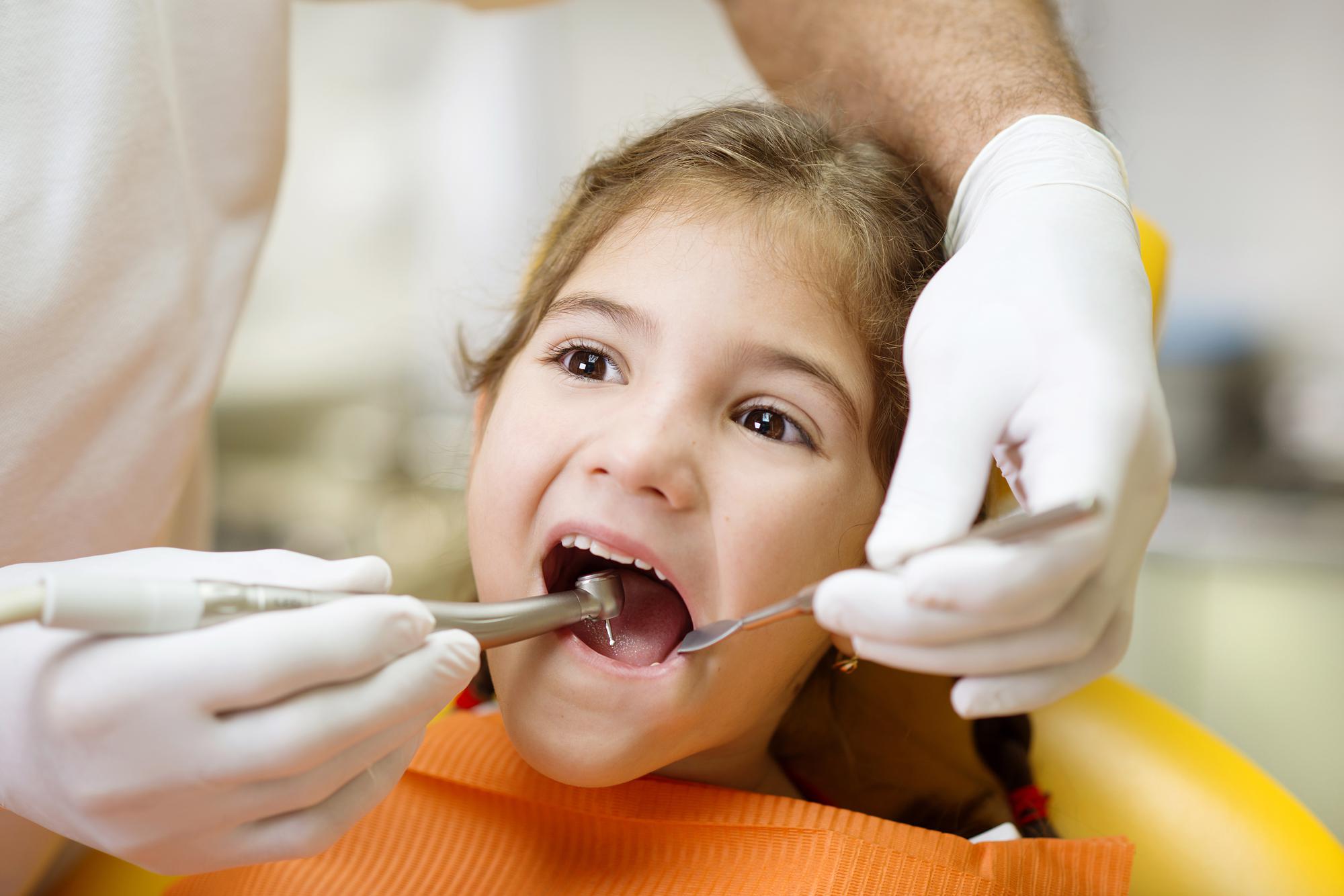 小児歯科　虫歯　予防