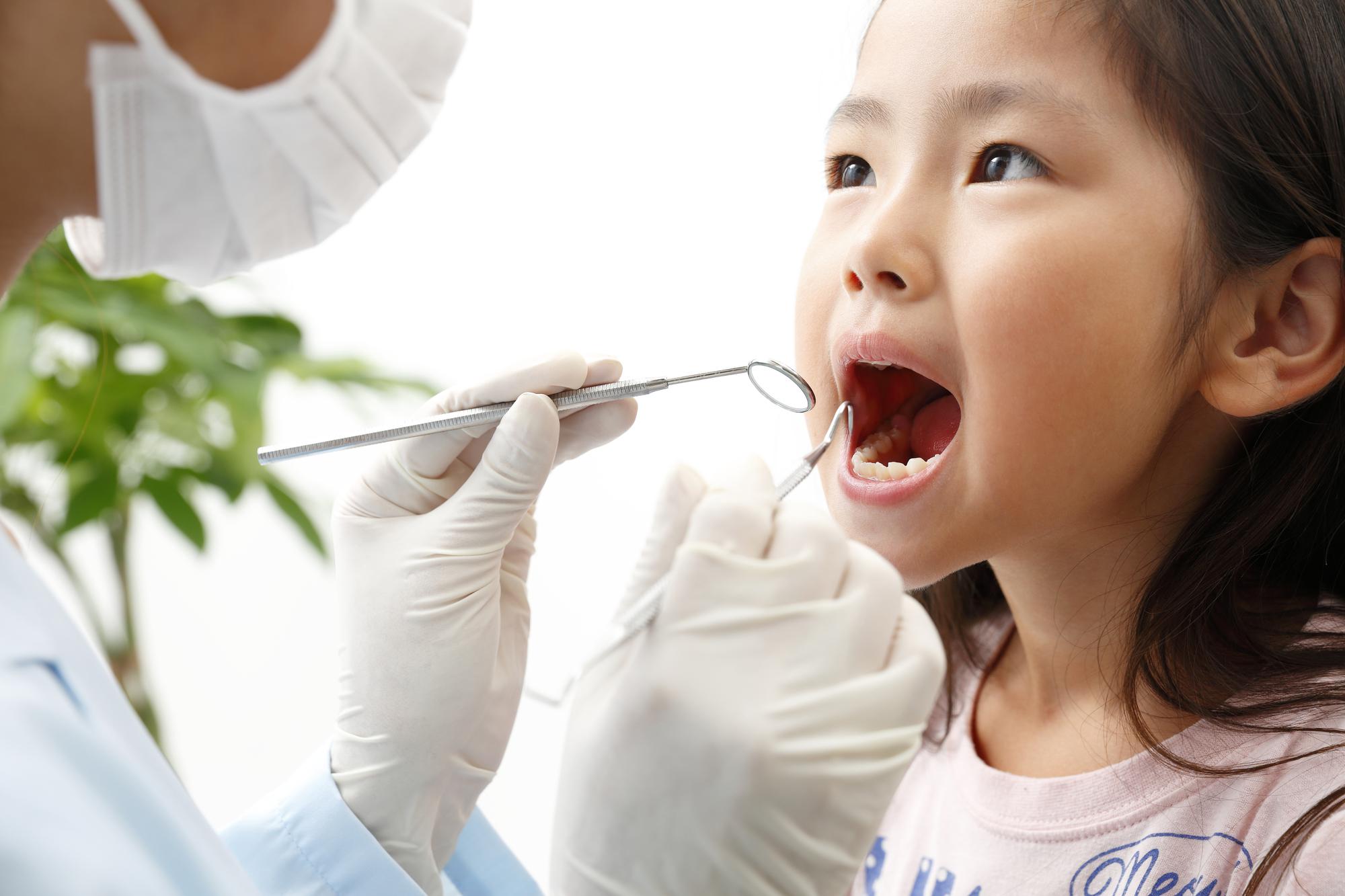 子ども　虫歯　予防