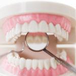 子どものガミースマイルは歯列矯正で治る？その治療法とは