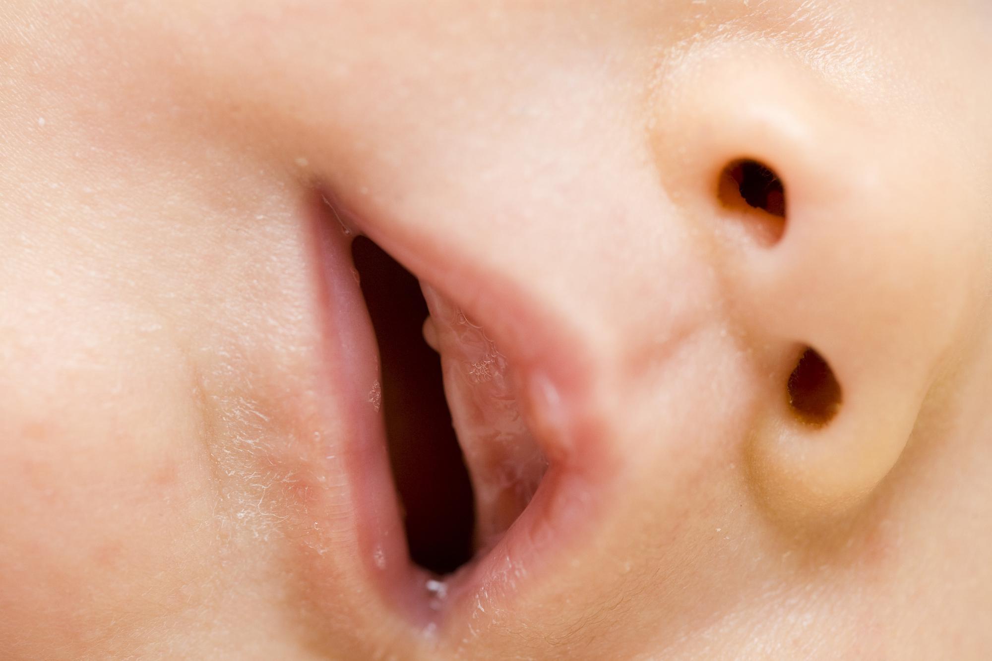 点 黒い 赤ちゃん 舌