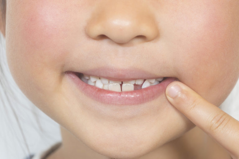 赤ちゃんの歯が生えない…原因ごとの治療法と注意点を詳しく解説